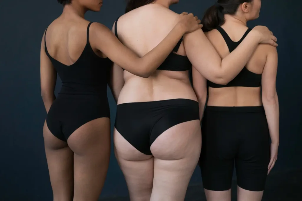Diferentes tipos de corpo posando com lingerie preta de costas.